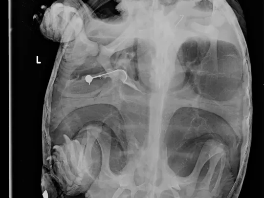 Radiographs of a snapping turtle who swallowed fish hooks.